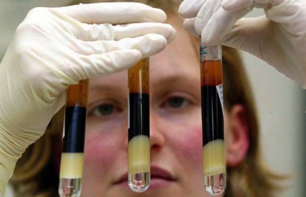  Cientistas descobrem mecanismo que explica “cura espontânea” do HIV!