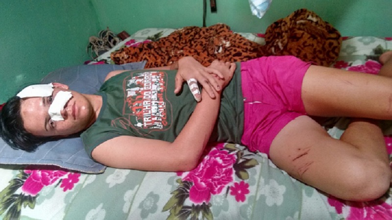 Jovem gay espancado com golpes de tamborete na Paraíba lamenta preconceito