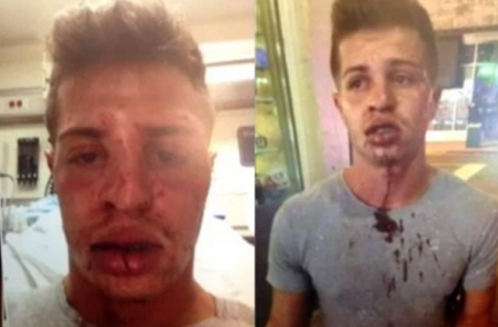  Jovem é brutalmente espancado após dar selinho no namorado em lanchonete do ‘Burger King’