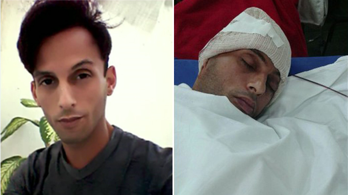 Homem é espancado por grupo de homofóbicos na Zona Oeste do Rio