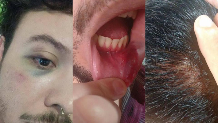 SP: grupo de travestis arrisca a própria vida para salvar gays de espancamento