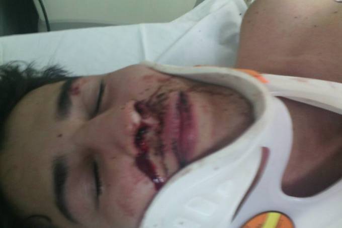 Jovem gay pede ajuda após assalto, mas é espancado no Centro de SP