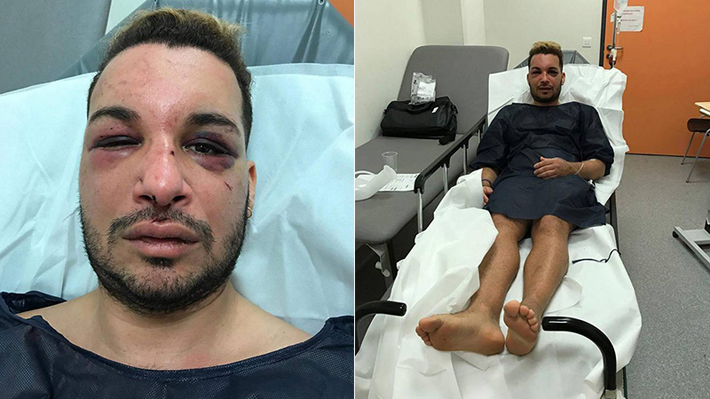 Ativista gay é sequestrado, agredido e estuprado por dois dias