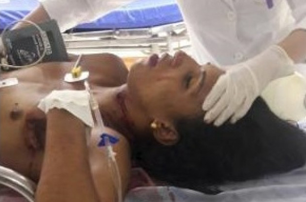 Travesti é alvejada com dez tiros após chamar homem de “bofe”