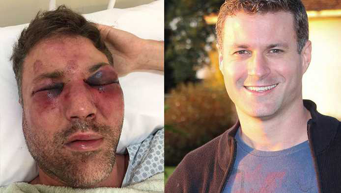 Arquiteto é espancado durante festa em Ponta Grossa; vítima acredita em homofobia