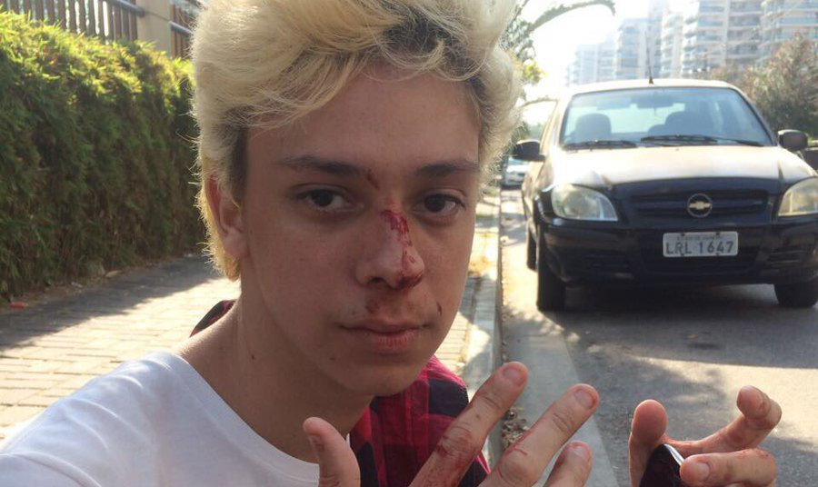 Vítima de homofobia, Victor Meynel é agredido no Rock In Rio: “Violência não tem justificativa”