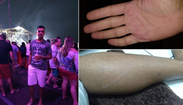 Jovem é espancado por seguranças durante show da dupla Jorge e Mateus: “Medo de morrer”