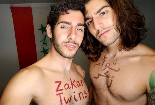  Gêmeos e dotados: irmãos Michael e Zach Zakar posam como veio ao mundo