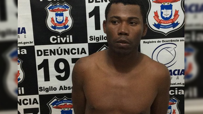 Travesti deficiente é estuprada, espancada, tem braço quebrado e suspeito é preso