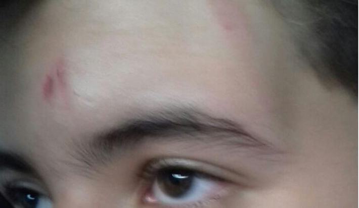 Vítima de bullying, estudante é agredido com cadeirada no rosto em sala de aula