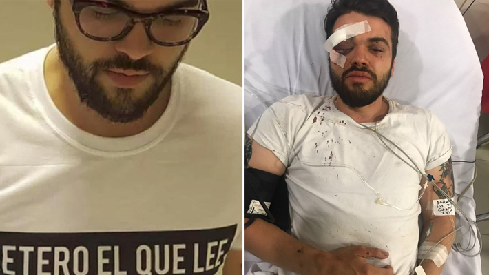 Atleta argentino pode ficar cego depois de agressões por “comportamento gay”