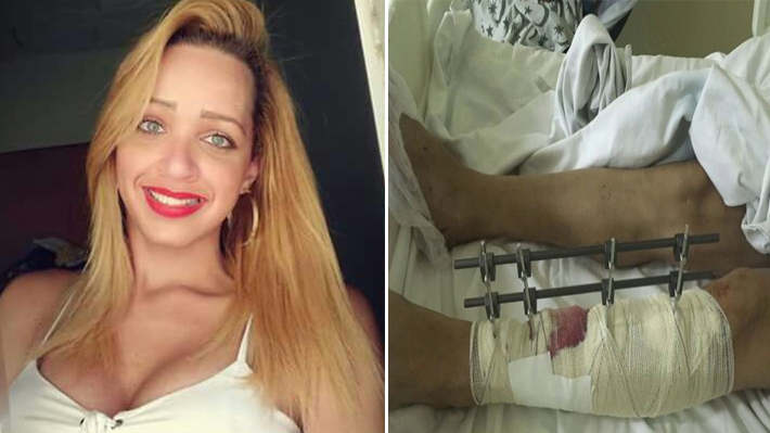 Homem agride e atropela transexual na Zona Oeste do Rio; vítima quase teve o pé amputado