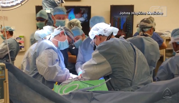  Hospital realiza primeiro transplante de pênis e escroto no mundo