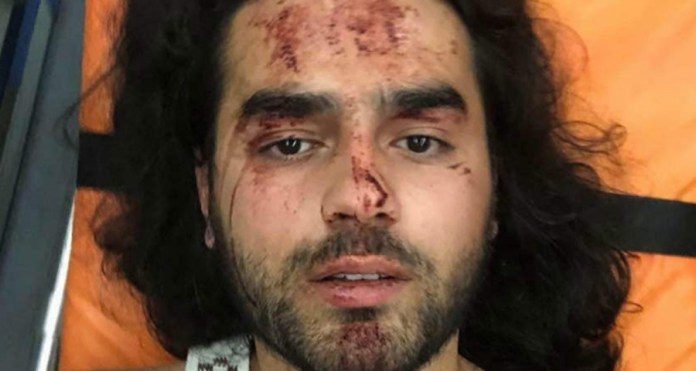 Ativistas gays ficam gravemente feridos após serem atacados por 30 homofóbicos