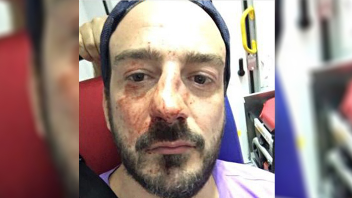 Presidente de associação que ajuda estrangeiros LGBT sofre agressão homofóbica em Paris