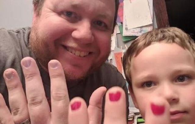 Pai pinta as unhas para ajudar filho a superar bullying que sofreu na escola