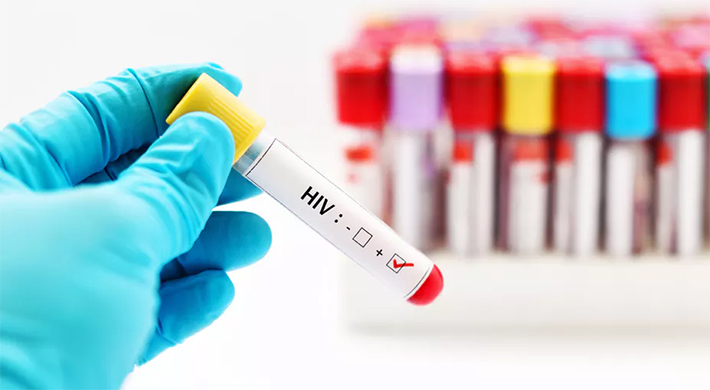 Ministério da Saúde divulga que 73% das novas infecções de HIV ocorrem no sexo masculino