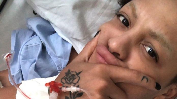 Pabllo Vittar passa por cirurgia no joelho: “Quebrei um pedacinho de um osso”