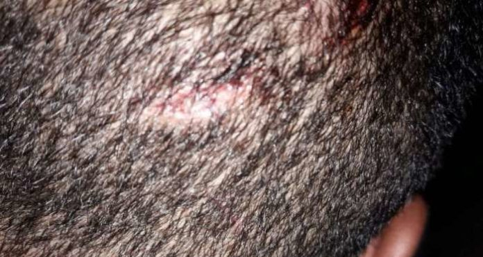 Jovem gay é agredido em terminal de Niterói e alega homofobia: “Pensei que fosse morrer”