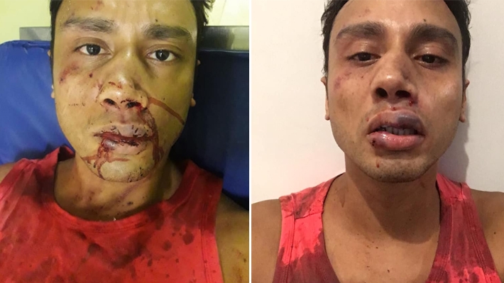  Jovem gay é atacado por seis homofóbicos na Zona Sul do Rio: “Eu achei que fosse morrer”
