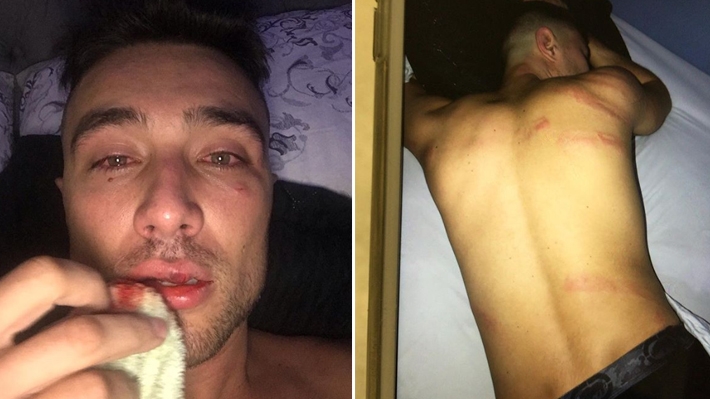  Youtuber gay Guigo Kieras é espancado por policiais durante bloco em SP