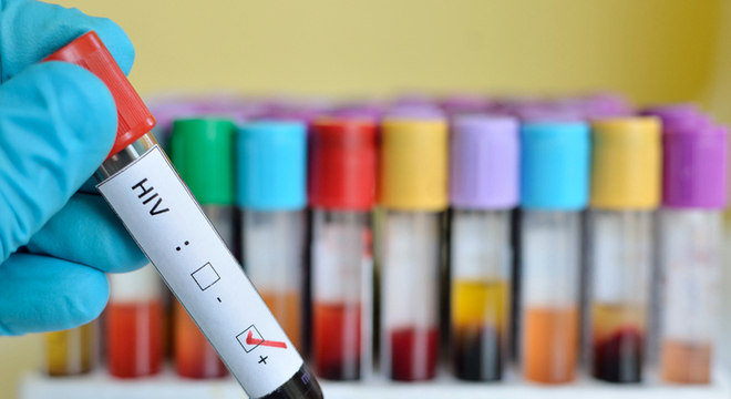 Em 12 cidades brasileiras, um em cada 5 homens que fazem sexo com homens tem HIV, diz estudo