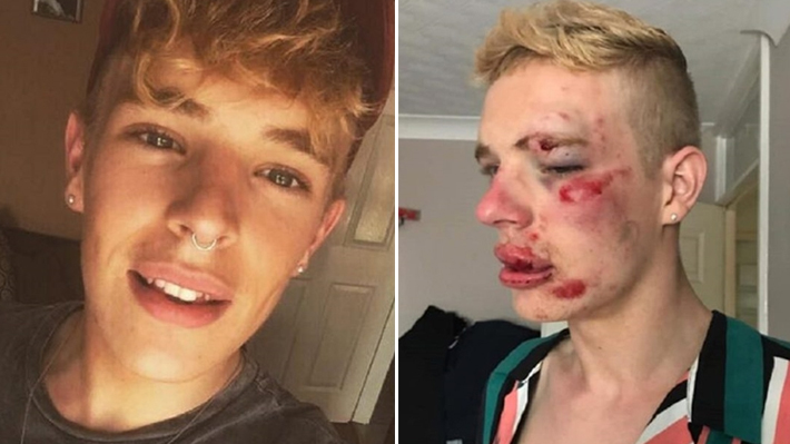 Jovem gay é brutalmente espancado por grupo de homofóbicos na Inglaterra