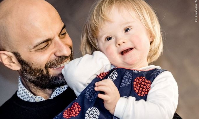  Gay solteiro adota bebê com síndrome de down rejeitado por 20 famílias