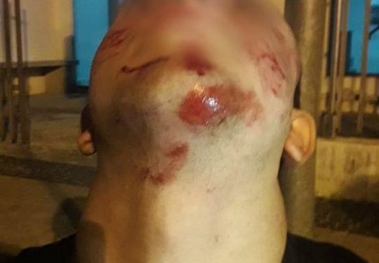 Jovem é agredido no interior de SP e alega homofobia: “Disseram que ‘viado’ tinha que morrer”