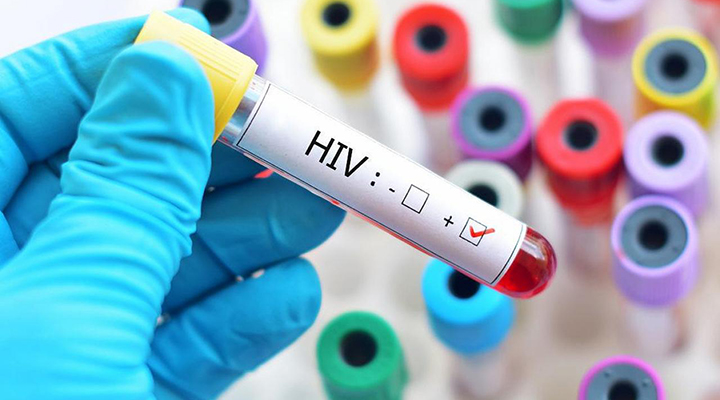 Novo tipo do vírus HIV é descoberto pela primeira vez em 20 anos