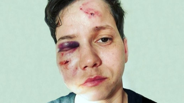  Karol Eller, lésbica apoiadora de Bolsonaro, sofre ataque homofóbico