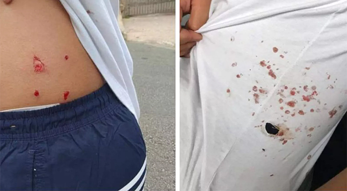 Rapaz é agredido com pedaço de pau cheio de pregos após beijar namorado em terminal de SP