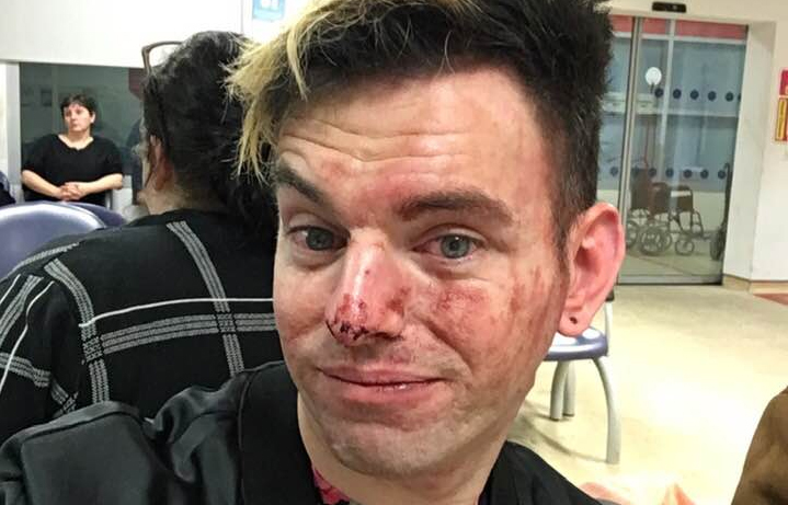 Homem é espancado por grupos de homofóbicos ao tentar defender amigos gays