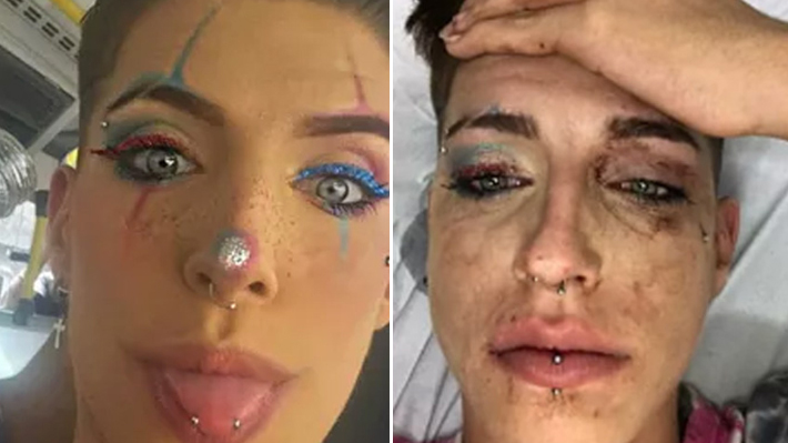 Jovem sofre ataque homofóbico em saída de bloco de Carnaval em São Paulo