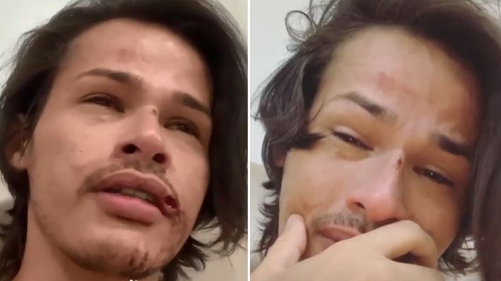 Vítima de homofobia no carnaval de Salvador, jovem gay desabafa: “Isso não pode continuar acontecendo”