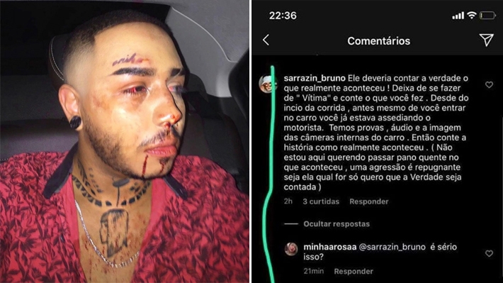  Reviravolta! Jovem gay espancado em Manaus teria dado em cima de motorista: o assédio justifica a agressão?