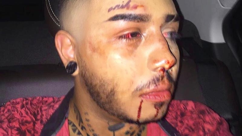  Jovem gay de Manaus diz ter sofrido agressão homofóbica por motorista do aplicativo 99: “Viado precisa morrer”