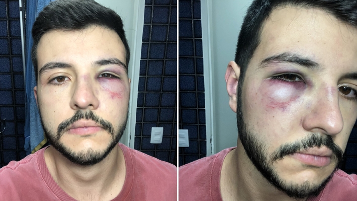  Jornalista Matheus Ribeiro é vítima de agressão após reagir a assalto: “Não reaja, valorize sua vida”