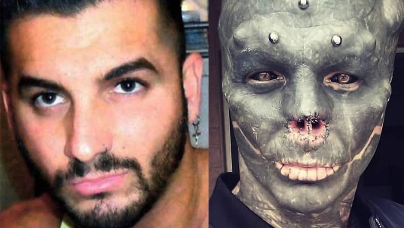 Francês retira orelhas e nariz para virar um ‘alien negro’, mas ainda quer mais: “Transformação 18%”