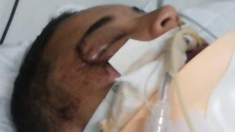 Família cria vakinha online para comprar remédios a jovem lésbica brutalmente espancada em 2019