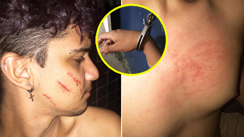 Jovem é humilhado e algemado por policias após denunciar agressão de vizinhos homofóbicos