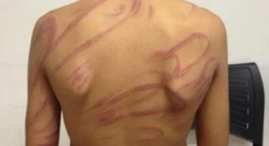 Em Rondônia, tio espanca sobrinho após jovem assumir homossexualidade