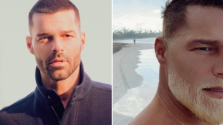  Ricky Martin surpreende seguidores e aparece com barba descolorida: “Quando entediado, descolore”