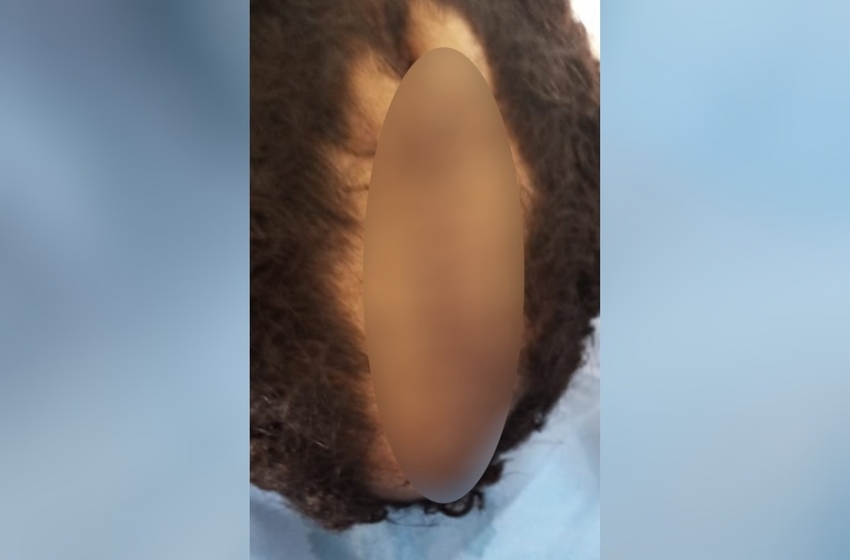  Revoltante! Pai corta couro cabeludo do filho de 6 anos por achar que corte da criança era de “homossexual”