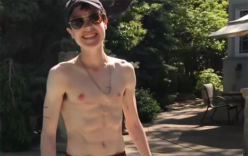 Elliot Page compartilha primeira foto sem camisa após cirurgia de retirada dos seios