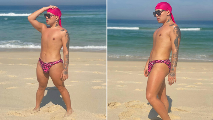 Gloria Groove revela que fez procedimentos estéticos: “Troquei tudo que não gostava”