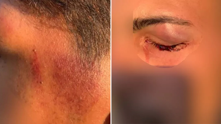 Casal gay denuncia agressões da PM durante abordagem em Goiânia