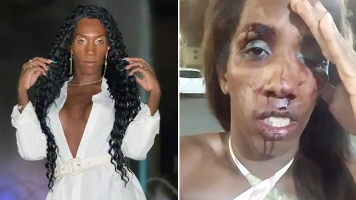  Ativista transexual é agredida por homem e três mulheres na saída de bar no Distrito Federal