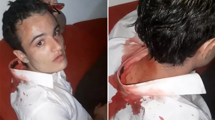 Aplicativo 99 terá que indenizar em R$ 10 mil passageiro que apanhou de motorista por ser gay