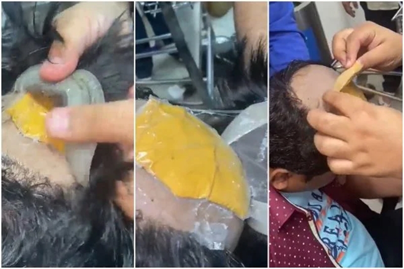  Homem é preso após ser flagrado com ouro debaixo da peruca e no ânus, em aeroporto na Índia